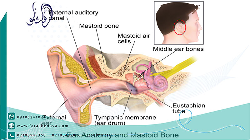 ماستوئیدیت بیماری های گوش میانی و داخلی 