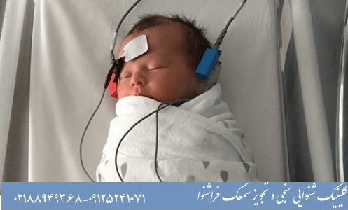 تست شنوایی نوزاد چند مرحله دارد