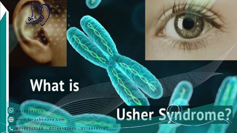 سندرم آشر(Usher) و راههای تشخیص و درمان آن
